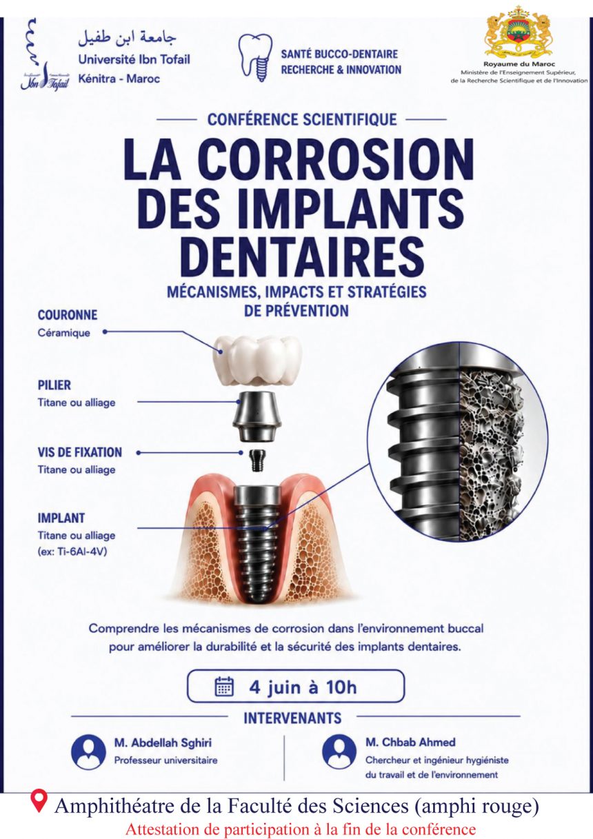 conférence sur la corrosion des implants dentaires